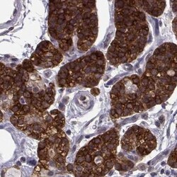 Invitrogen KIF13B Polyclonal Antibody 100 &mu;L; Unconjugated:Antibodies,