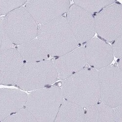 Invitrogen KIF13B Polyclonal Antibody 100 &mu;L; Unconjugated:Antibodies,