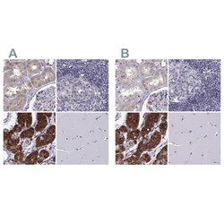 Invitrogen KIF13B Polyclonal Antibody 100 &mu;L; Unconjugated:Antibodies,