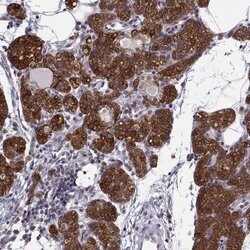 Invitrogen KIF13B Polyclonal Antibody 100 &mu;L; Unconjugated:Antibodies,