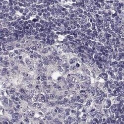 Invitrogen KIF13B Polyclonal Antibody 100 &mu;L; Unconjugated:Antibodies,