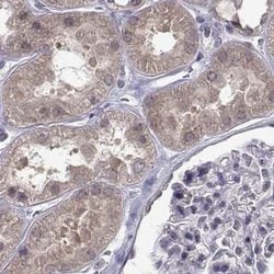 Invitrogen KIF13B Polyclonal Antibody 100 &mu;L; Unconjugated:Antibodies,
