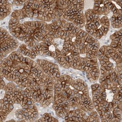 Invitrogen KIF13B Polyclonal Antibody 100 &mu;L; Unconjugated:Antibodies,