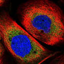 Invitrogen eIF4G3 Polyclonal Antibody 100 &mu;L; Unconjugated:Antibodies,