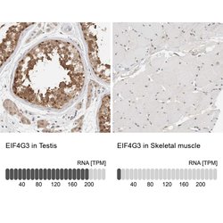 Invitrogen eIF4G3 Polyclonal Antibody 100 &mu;L; Unconjugated:Antibodies,
