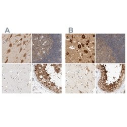 Invitrogen eIF4G3 Polyclonal Antibody 100 &mu;L; Unconjugated:Antibodies,