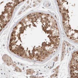 Invitrogen eIF4G3 Polyclonal Antibody 100 &mu;L; Unconjugated:Antibodies,