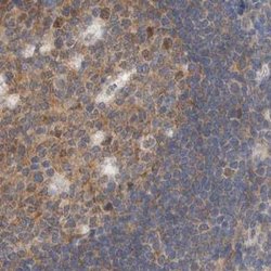 Invitrogen eIF4G3 Polyclonal Antibody 100 &mu;L; Unconjugated:Antibodies,