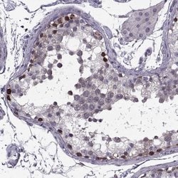 Invitrogen LETM2 Polyclonal Antibody 100 &mu;L; Unconjugated:Antibodies,