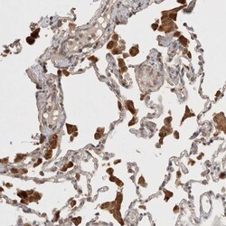 Invitrogen KLHL20 Polyclonal Antibody 100 &mu;L; Unconjugated:Antibodies,
