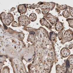Invitrogen KLHL20 Polyclonal Antibody 100 &mu;L; Unconjugated:Antibodies,
