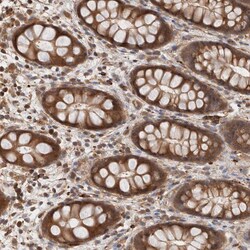 Invitrogen KLHL20 Polyclonal Antibody 100 &mu;L; Unconjugated:Antibodies,
