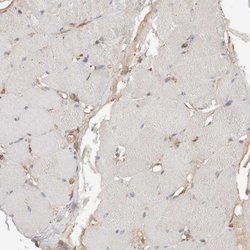 Invitrogen eIF4G3 Polyclonal Antibody 100 &mu;L | Buy Online | Invitrogen&trade; | Fisher Scientific