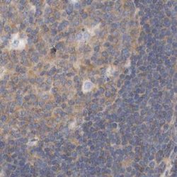 Invitrogen eIF4G3 Polyclonal Antibody 100 &mu;L | Buy Online | Invitrogen&trade; | Fisher Scientific