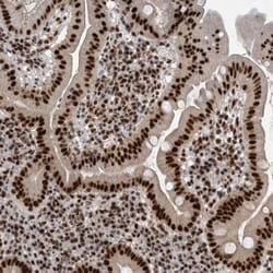 Invitrogen CDK11A Polyclonal Antibody 100 &mu;L; Unconjugated:Antibodies,