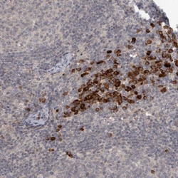 SLCO5A1 Polyclonal Antibody:Antibodies, Polyclonal