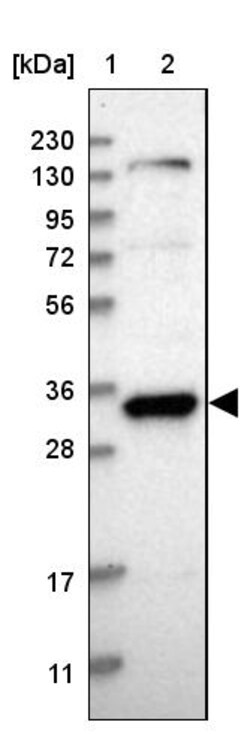 Invitrogen GTF2E2 Polyclonal Antibody 100 &mu;L | Buy Online | Invitrogen&trade; | Fisher Scientific