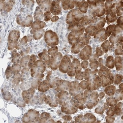 Invitrogen C8orf48 Polyclonal Antibody 100 μL; Unconjugated:Antibodies,