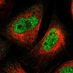 Invitrogen SPRTN Polyclonal Antibody 100 &mu;L; Unconjugated:Antibodies,