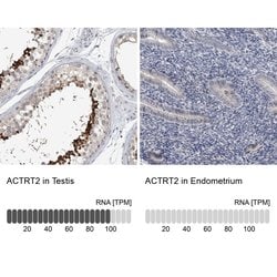 Invitrogen ACTRT2 Polyclonal Antibody 100 &mu;L; Unconjugated:Antibodies,