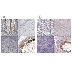 Invitrogen ACTRT2 Polyclonal Antibody 100 &mu;L; Unconjugated:Antibodies,