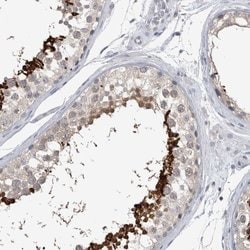 Invitrogen ACTRT2 Polyclonal Antibody 100 &mu;L; Unconjugated:Antibodies,