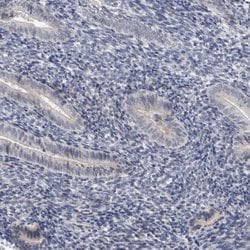 Invitrogen ACTRT2 Polyclonal Antibody 100 &mu;L; Unconjugated:Antibodies,