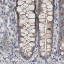 Invitrogen ACTRT2 Polyclonal Antibody 100 &mu;L; Unconjugated:Antibodies,