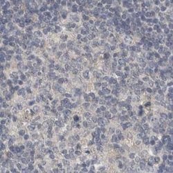 Invitrogen ACTRT2 Polyclonal Antibody 100 &mu;L; Unconjugated:Antibodies,