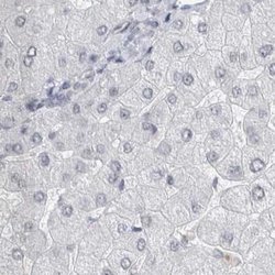 Invitrogen ACTRT2 Polyclonal Antibody 100 &mu;L; Unconjugated:Antibodies,