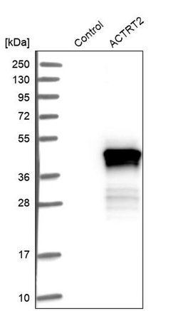 Invitrogen ACTRT2 Polyclonal Antibody 100 &mu;L; Unconjugated:Antibodies,