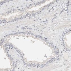 Invitrogen SDR16C5 Polyclonal Antibody 100 &mu;L; Unconjugated:Antibodies,