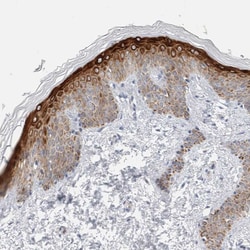 Invitrogen SDR16C5 Polyclonal Antibody 100 &mu;L; Unconjugated:Antibodies,