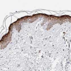 Invitrogen SDR16C5 Polyclonal Antibody 100 &mu;L; Unconjugated:Antibodies,
