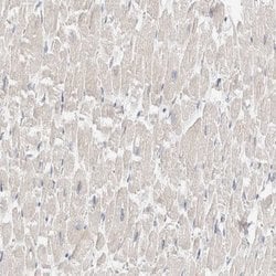 Invitrogen SDR16C5 Polyclonal Antibody 100 &mu;L; Unconjugated:Antibodies,