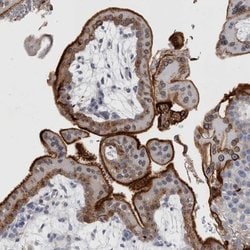 Invitrogen DNAJC24 Polyclonal Antibody 100 &mu;L; Unconjugated:Antibodies,