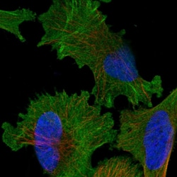 Invitrogen KNTC1 Polyclonal Antibody 100 &mu;L; Unconjugated:Antibodies,
