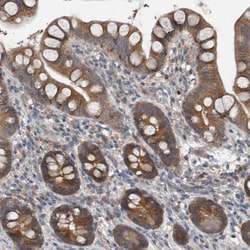 Invitrogen KNTC1 Polyclonal Antibody 100 &mu;L; Unconjugated:Antibodies,