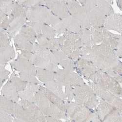 Invitrogen KNTC1 Polyclonal Antibody 100 &mu;L; Unconjugated:Antibodies,