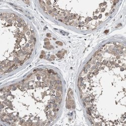 Invitrogen KNTC1 Polyclonal Antibody 100 &mu;L; Unconjugated:Antibodies,