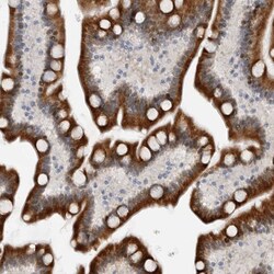 Invitrogen PCMTD1 Polyclonal Antibody 100 &mu;L; Unconjugated:Antibodies,