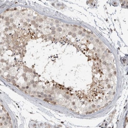 Invitrogen KIAA1731NL Polyclonal Antibody 100 &mu;L; Unconjugated:Antibodies,