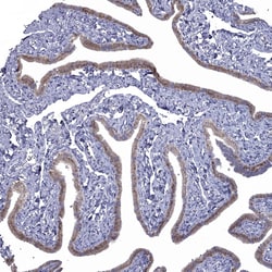 Invitrogen NRARP Polyclonal Antibody 100 &mu;L; Unconjugated:Antibodies,