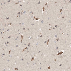 Invitrogen RAB32 Polyclonal Antibody 100 &mu;L; Unconjugated:Antibodies,