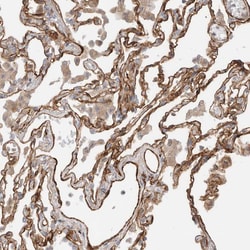 Invitrogen RAB32 Polyclonal Antibody 100 &mu;L; Unconjugated:Antibodies,