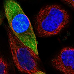 Invitrogen ACOT7 Polyclonal Antibody 100 &mu;L; Unconjugated:Antibodies,