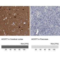 Invitrogen ACOT7 Polyclonal Antibody 100 &mu;L; Unconjugated:Antibodies,