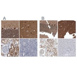 Invitrogen ACOT7 Polyclonal Antibody 100 &mu;L; Unconjugated:Antibodies,