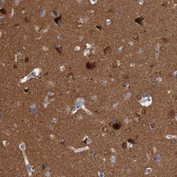 Invitrogen ACOT7 Polyclonal Antibody 100 &mu;L; Unconjugated:Antibodies,