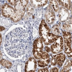 Invitrogen ACOT7 Polyclonal Antibody 100 &mu;L; Unconjugated:Antibodies,